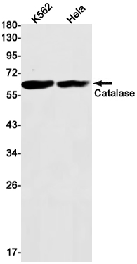 Rabbit Monoclonal Antibody to Catalase