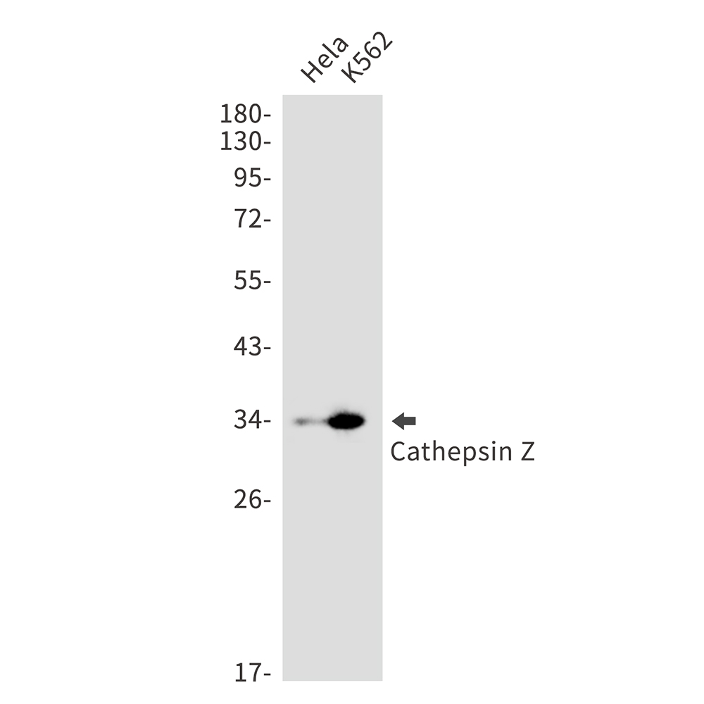 Rabbit Monoclonal Antibody to Cathepsin Z
