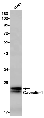 Rabbit Monoclonal Antibody to Caveolin 1