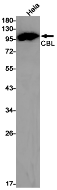Rabbit Monoclonal Antibody to CBL