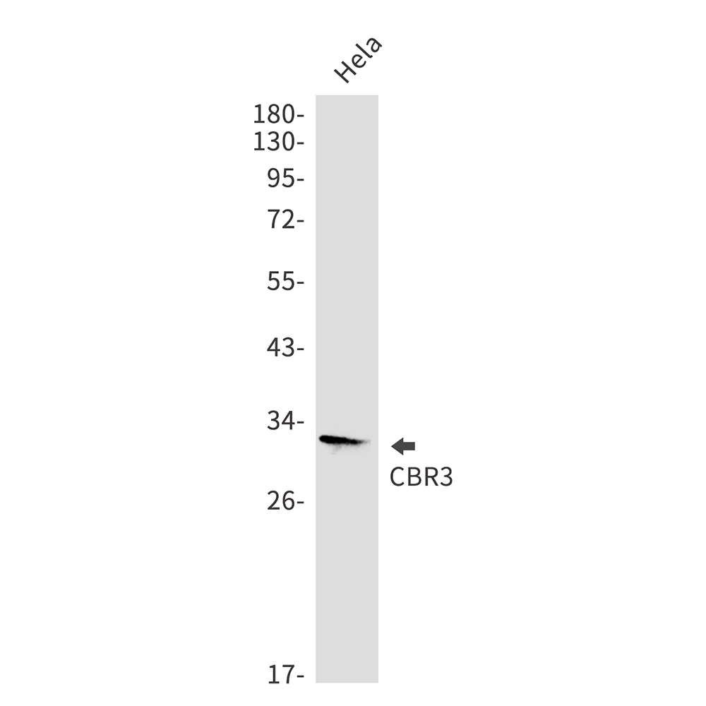 Rabbit Monoclonal Antibody to CBR3