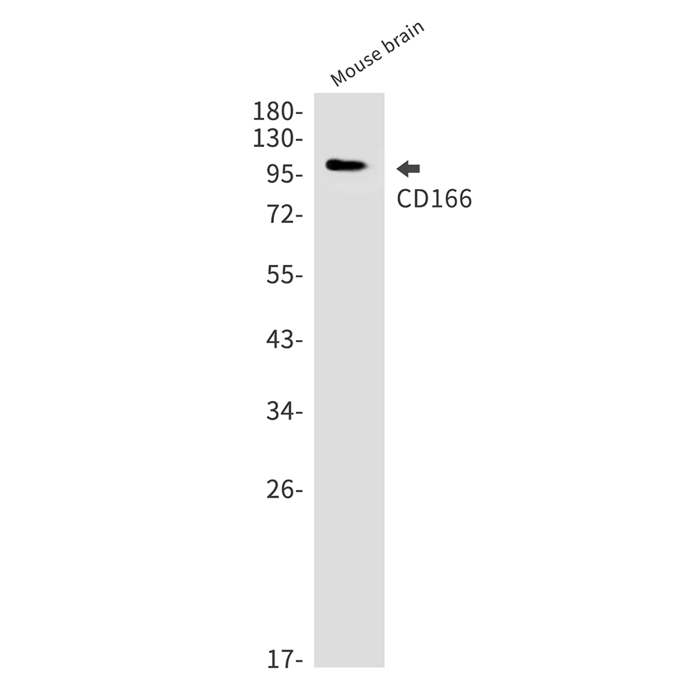 Rabbit Monoclonal Antibody to CD166