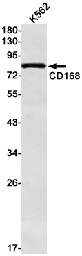 Rabbit Monoclonal Antibody to CD168