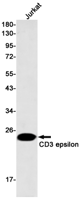 Rabbit Monoclonal Antibody to CD3 epsilon