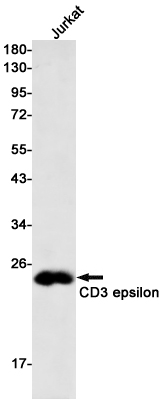 Rabbit Monoclonal Antibody to CD3 epsilon