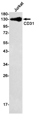 Rabbit Monoclonal Antibody to CD31