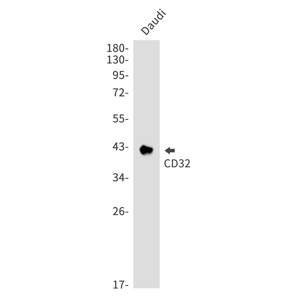 Rabbit Monoclonal Antibody to CD32