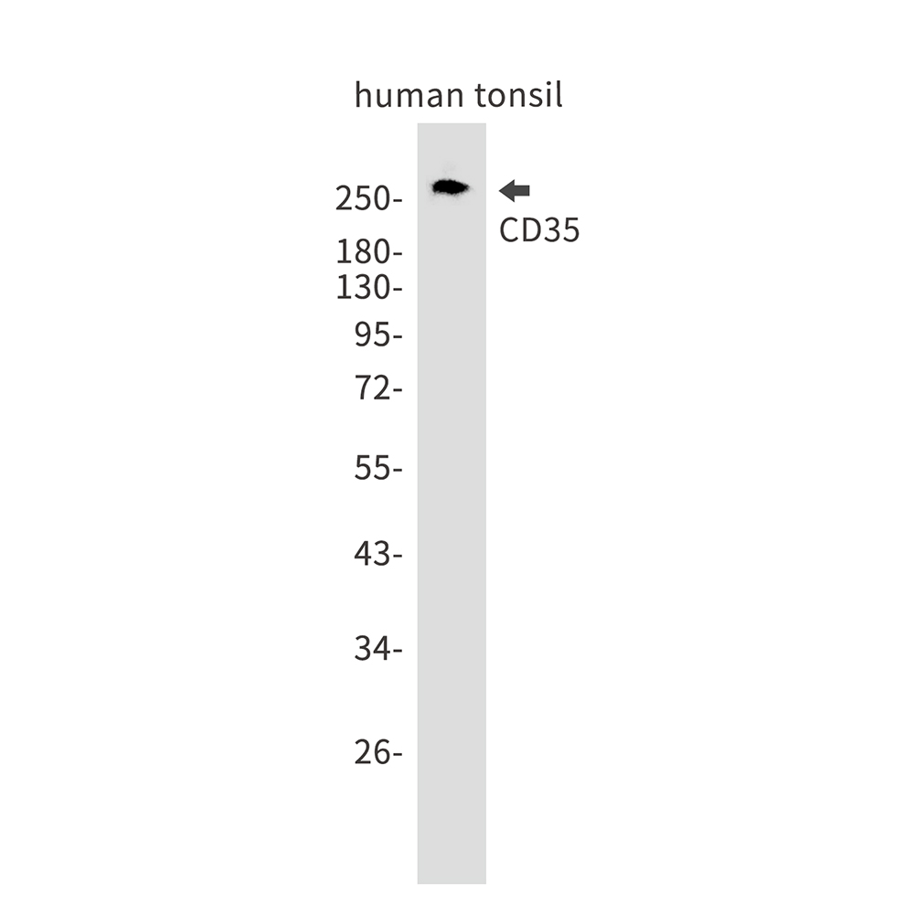 Rabbit Monoclonal Antibody to CD35