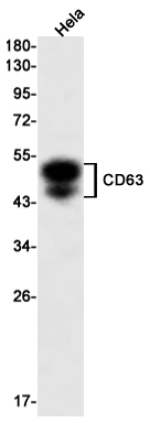 Rabbit Monoclonal Antibody to CD63