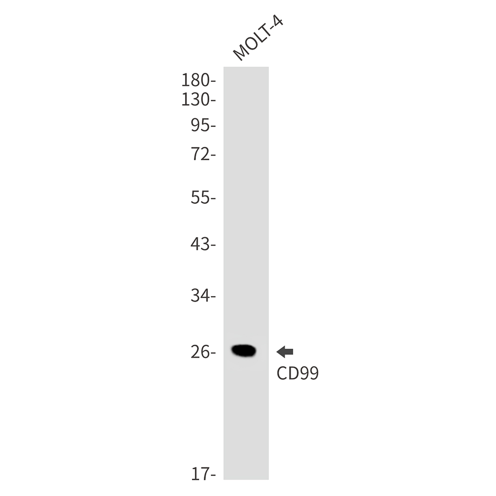 Rabbit Monoclonal Antibody to CD99