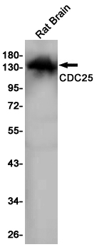 Rabbit Monoclonal Antibody to CDC25