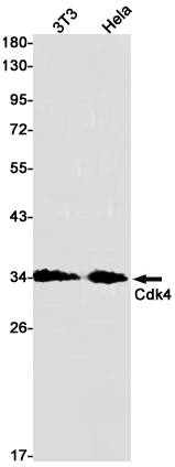 Rabbit Monoclonal Antibody to CDK4
