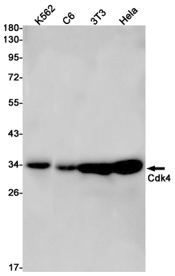 Rabbit Monoclonal Antibody to CDK4