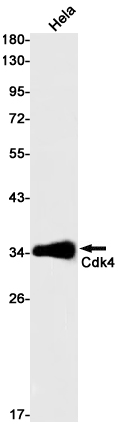 Rabbit Monoclonal Antibody to CDK4