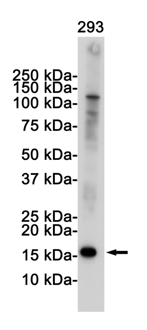 Rabbit Monoclonal Antibody to CDKN2A/p16INK4a