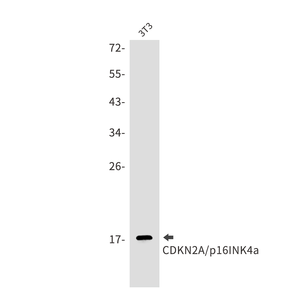 Rabbit Monoclonal Antibody to CDKN2A/p16INK4a