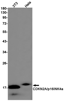 Rabbit Monoclonal Antibody to CDKN2A/p16INK4a