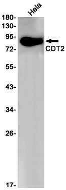 Rabbit Monoclonal Antibody to CDT2