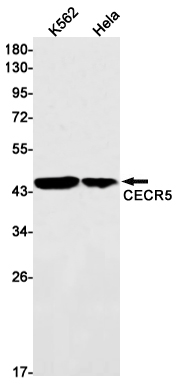 Rabbit Monoclonal Antibody to CECR5
