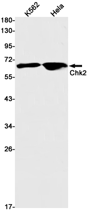 Rabbit Monoclonal Antibody to Chk2