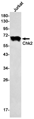 Rabbit Monoclonal Antibody to Chk2