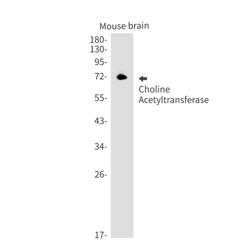 Rabbit Monoclonal Antibody to Choline Acetyltransferase