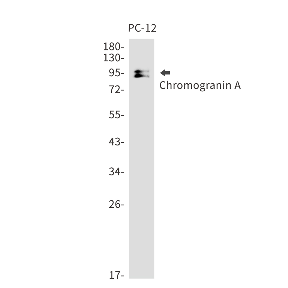 Rabbit Monoclonal Antibody to Chromogranin A
