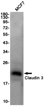 Rabbit Monoclonal Antibody to Claudin 3