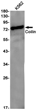 Rabbit Monoclonal Antibody to Coilin