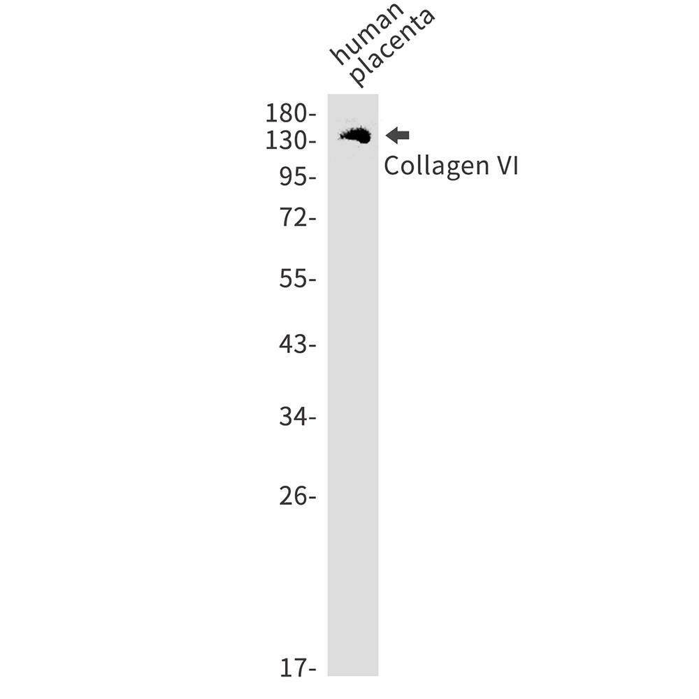 Rabbit Monoclonal Antibody to Collagen VI alpha 1