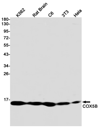 Rabbit Monoclonal Antibody to COX5B