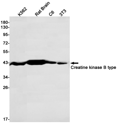 Rabbit Monoclonal Antibody to Creatine Kinase B type