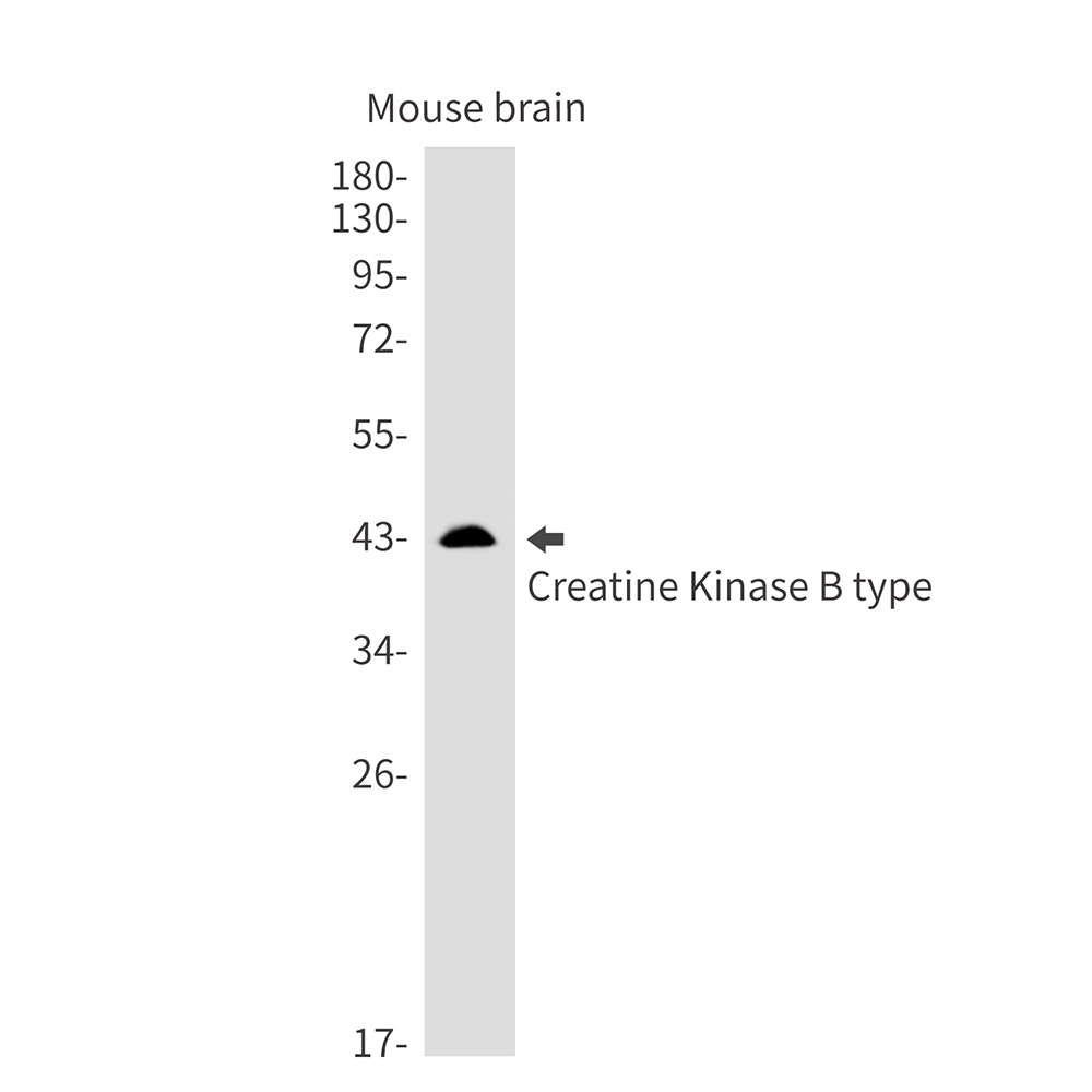 Rabbit Monoclonal Antibody to Creatine Kinase B type