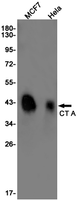 Rabbit Monoclonal Antibody to CT A