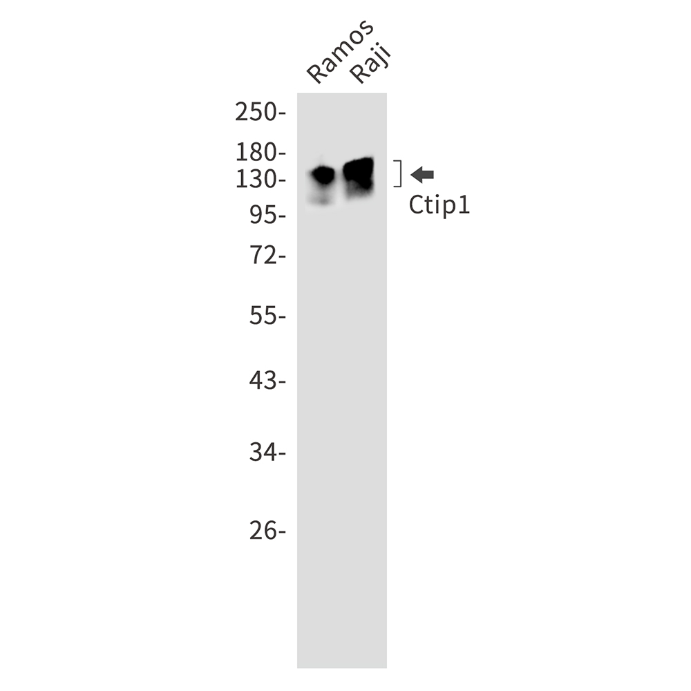 Rabbit Monoclonal Antibody to Ctip1