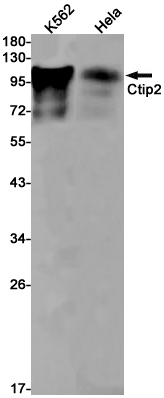 Rabbit Monoclonal Antibody to Ctip2