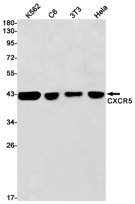 Rabbit Monoclonal Antibody to CXCR5