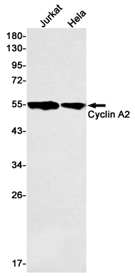 Rabbit Monoclonal Antibody to Cyclin A2