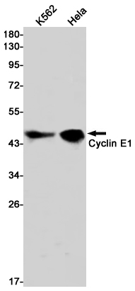 Rabbit Monoclonal Antibody to Cyclin E1