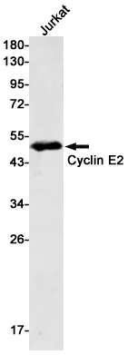 Rabbit Monoclonal Antibody to Cyclin E2