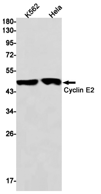 Rabbit Monoclonal Antibody to Cyclin E2