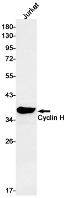 Rabbit Monoclonal Antibody to Cyclin H