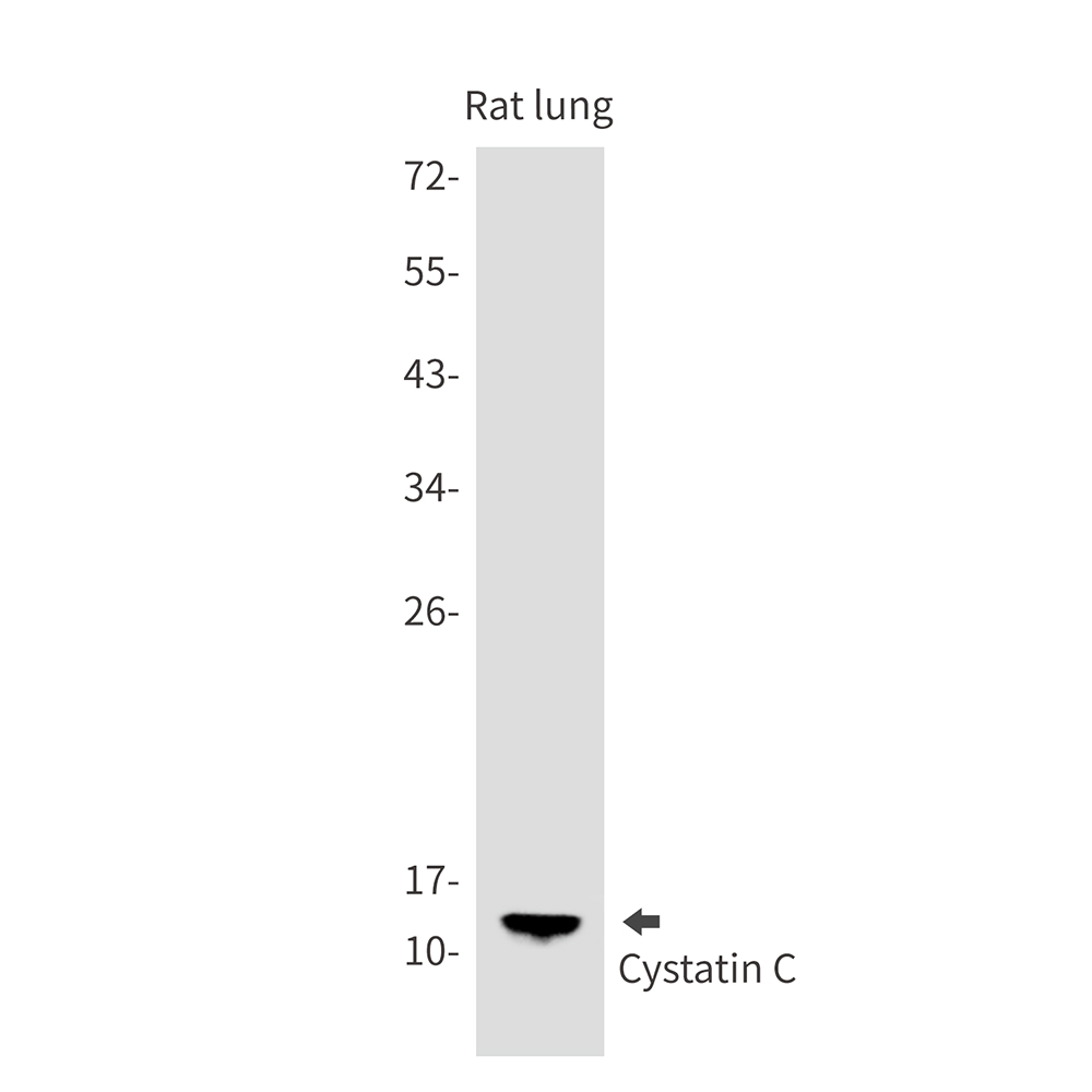Rabbit Monoclonal Antibody to Cystatin C