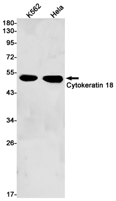 Rabbit Monoclonal Antibody to Cytokeratin 18