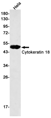 Rabbit Monoclonal Antibody to Cytokeratin 18