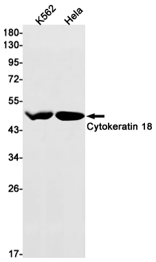 Rabbit Monoclonal Antibody to Cytokeratin 18