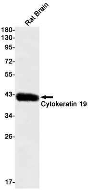 Rabbit Monoclonal Antibody to Cytokeratin 19