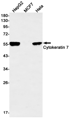 Rabbit Monoclonal Antibody to Cytokeratin 7