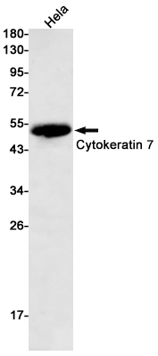 Rabbit Monoclonal Antibody to Cytokeratin 7