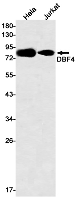 Rabbit Monoclonal Antibody to DBF4